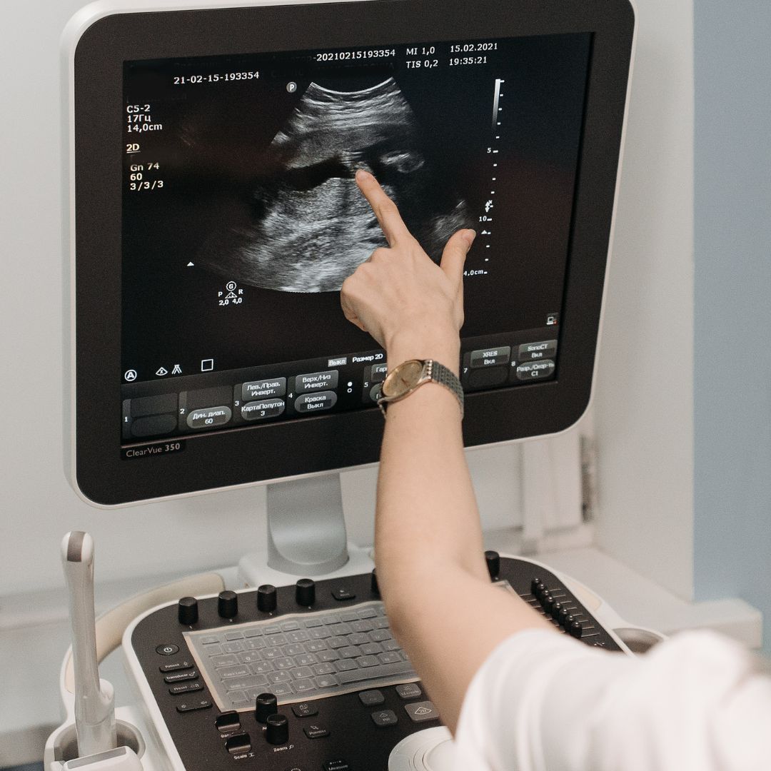 ultrasound tech reading screen